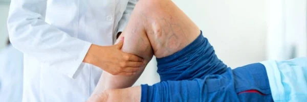 varis-belirtileri-muayenesi varis muayenesi doktor