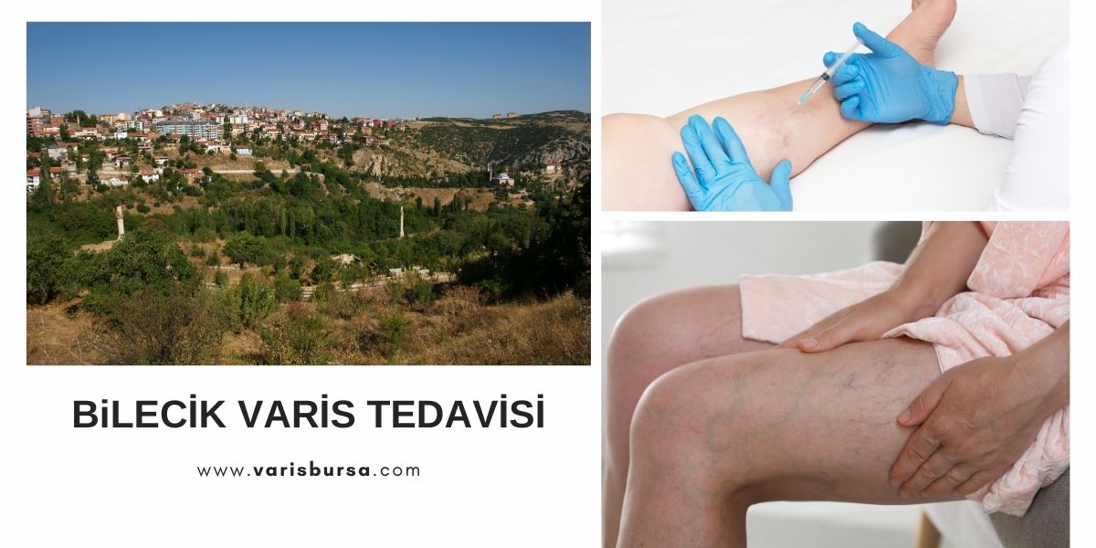 Varis Tedavisi