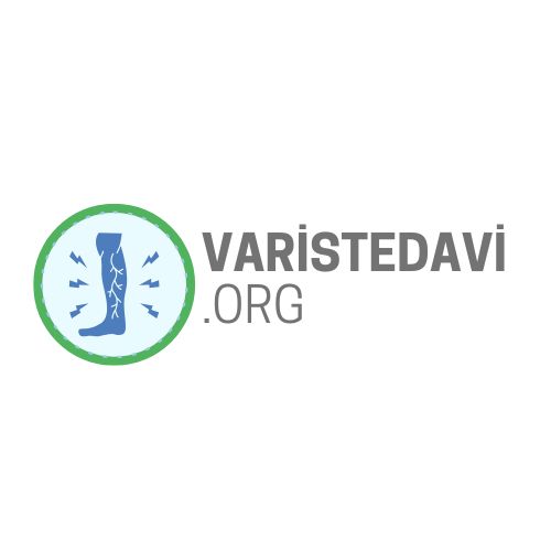 Varis Tedavisi